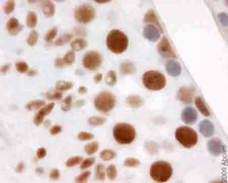 ab54393 (prediluted) staining XRCC1 in mouse tissue (testis) by Immunohistochemistry.