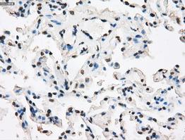 ab118008 at 1/50 dilution, staining XRCC4 in Paraffin- embedded Human Lung tissue by Immunohistochemistry.