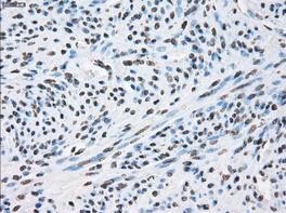 ab118008 at 1/50 dilution, staining XRCC4 in Paraffin- embedded Human endometrium tissue by Immunohistochemistry.
