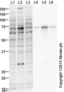 All lanes : Anti-YAP1 antibody (ab39361) at 1 µg/mlLane 1 : SW480 (Human colon adenocarcinoma cell line) Whole Cell Lysate with 5% BSA blockingLane 2 : Caco 2 (Human colonic carcinoma cell line) Whole Cell Lysate with 5% BSA blockingLane 3 : LS147T (Human colon cancer) Whole Cell Lysate with 5% BSA blockingLane 4 : SW480 (Human colon adenocarcinoma cell line) Whole Cell Lysate with 1% milk blockingLane 5 : Caco 2 (Human colonic carcinoma cell line) Whole Cell Lysate with 1% milk blockingLane 6 : LS147T (Human colon cancer) Whole Cell Lysate with 1% milk blockingLysates/proteins at 10 µg per lane.SecondaryGoat Anti-Rabbit IgG H&L (HRP) (ab97051) at 1/10000 dilution (Goat polyclonal Secondary Antibody to Rabbit IgG - H&L (HRP))developed using the ECL techniquePerformed under reducing conditions.
