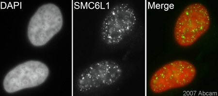 ab18039 (1/200) staining SMC6L in HeLa cells (green). Cells were fixed in methanol, permeabilised with 0.5% Triton X100/PBS and counterstained with DAPI in order to highlight the nucleus (red). Please refer to abreview for further experimental details.See Abreview