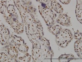 SMC6L1 antibody (ab57759) used in immunohistochemistry at 3ug/ml on formalin fixed and paraffin embedded human placenta.