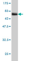 Western blot against tagged recombinant protein immunogen using ab57682 VPS72 antibody at 1ug/ml. 