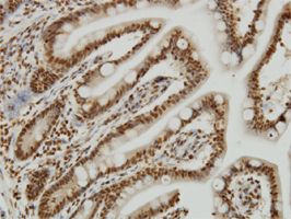 YY1 antibody (ab58068) used in immunohistochemistry at 3ug/ml on formalin fixed and paraffin embedded human small Intestine.