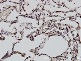 YY1 antibody (ab58066) used in immunohistochemistry at 3ug/ml on formalin fixed and paraffin embedded human lung.