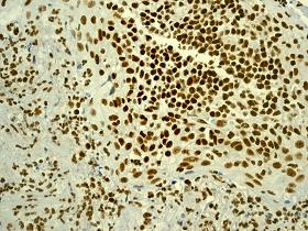 Immunohistochemistry (Formalin/PFA-fixed paraffin-embedded sections) analysis human tonsil tissue labelling YY1 with unpurified ab109237 at 1/250.