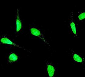 Immunocytochemistry/Immunofluorescence analysis of HeLa cells labelling YY1 with unpurified ab109237 at 1/100.