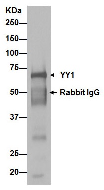 ab109237 (purified) at 1/30 immunoprecipitating YY1 in Y79 cells. For western blotting, a Peroxidase-conjugated goat anti-rabbit IgG was used as the secondary antibody (1/1000).Blocking buffer and concentration: 5% NFDM/TBST.Diluting buffer and concentration: 5% NFDM /TBST.
