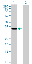 All lanes : Anti-ZADH1 antibody (ab72875) at 1/500 dilutionLane 1 : ZADH1 transfected 293T cell lysateLane 2 : non transfected 293T cell lysateLysates/proteins at 25 µg per lane.SecondaryGoat Anti-Mouse IgG (H&L)-HRP at 1/2500 dilution