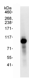 Detection of Smek1 by Western Blot of Immunprecipitate. ab70635 at 1µg/ml staining Smek1 in HeLa whole cell lysate immunoprecipitated using ab70635 at 3µg/mg lysate (1 mg/IP; 20% of IP loaded/lane). Detection: Chemiluminescence with exposure time of 0.5 seconds.