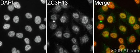 ab70802 (1/400) staining ZC3H13 in HeLa cells (green). Cells were fixed in paraformaldehyde, permeabilised with 0.5% TritonX100/PBS and counterstained with DAPI in order to highlight the nucleus (red). Please refer to abreview for further experimental details.See Abreview