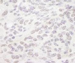 ab91618, at 1/250 dilution, staining Smek1 in formalin-fixed paraffin-embedded Mouse teratoma tissue by Immunohistochemistry using DAB staining.