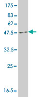 Western blot against tagged recombinant protein immunogen using ab56771 ZFYVE16 antibody at 1ug/ml.