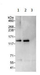 Detection of Human ZHX3 by Western Blot and Immunoprecipitation. Samples: Whole cell lysate from HeLa (1 mg for IP, 20% of IP loaded) cells. ab99350 used for WB at 1 ug/ml and used for IP at 3 ug/mg lysate (lane 1). ZHX3 was also immunoprecipitated by another rabbit anti-ZHX3 antibody (lane 2) and control IgG (lane 3). Detection Chemiluminescence with exposure times of 10 seconds.