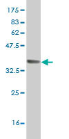 Western blot against tagged recombinant protein immunogen using ab58318 Zic 3 antibody at 1ug/ml.