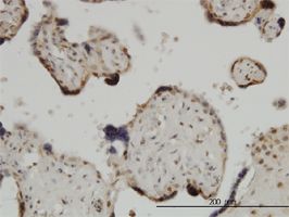 ZIC4 antibody (ab57891) used in immunohistochemistry at 3ug/ml on formalin fixed and paraffin embedded human placenta.