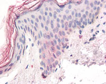 ab115566, at 3.75µg/ml, staining ZIC5 in Formalin-fixed, Paraffin-embedded Human Skin tissue by Immunohistochemistry followed by biotinylated secondary antibody, alkaline phosphatase-streptavidin and chromogen.