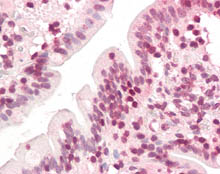 ab115566, at 3.75µg/ml, staining ZIC5 in Formalin-fixed, Paraffin-embedded Human Small intestine tissue by Immunohistochemistry followed by biotinylated secondary antibody, alkaline phosphatase-streptavidin and chromogen. .