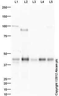All lanes : Anti-Zinc Alpha 2 Glycoprotein antibody (ab117275) at 1 µg/mlLane 1 : Liver (Human) Tissue Lysate - adult normal tissue (ab29889)Lane 2 : Human Plasma Total Protein LysateLane 3 : Heart (Human) Tissue Lysate - adult normal tissue (ab29431)Lane 4 : Lung (Human) Tissue LysateLane 5 : Adipose (Human) Total Protein Lysate - adult normal tissue (ab28980)Lysates/proteins at 10 µg per lane.SecondaryGoat Anti-Rabbit IgG H&L (HRP) preadsorbed (ab97080) at 1/5000 dilutiondeveloped using the ECL techniquePerformed under reducing conditions.