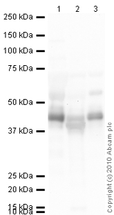 All lanes : Anti-Zinc Alpha 2 Glycoprotein antibody (ab47116) at 1 µg/mlLane 1 : Human Plasma Total Protein LysateLane 2 : Liver (Human) Tissue Lysate - adult normal tissue (ab29889)Lane 3 : Testis (Human) Tissue Lysate - adult normal tissue (ab30257)Lysates/proteins at 10 µg per lane.SecondaryGoat Anti-Rabbit IgG H&L (HRP) preadsorbed (ab97080) at 1/5000 dilutiondeveloped using the ECL techniquePerformed under reducing conditions.