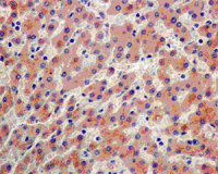 Immunohistochemical analysis of paraffin-embedded Human liver tissue labeling Zinc Alpha 2 Glycoprotein with ab180122 at 1/500 dilution followed by Goat anti rabbit IgG(HRP) and Hematoxylin counter-staining.