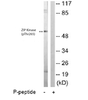 All lanes : Anti-ZIP Kinase (phospho T265) antibody (ab63395) at 1/500 dilutionLane 1 : Extracts of HuvEc cellsLane 2 : Extracts of HuvEc cells plus phospho petide