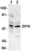 All lanes : Anti-ZIP Kinase antibody (ab2057) at 1/500 dilutionLane 1 : HeLa whole cell lysateLane 2 : Jurkat whole cell lysateObserved band size : 40 kDa (why is the actual band size different from the predicted?)