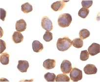 ab2057 at 10µg/ml staining of ZIP kinase in Jurkat cell by ICC/IF
