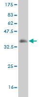 Western blot against tagged recombinant protein immunogen using ab57211 ZNDR1 antibody at 1ug/ml.