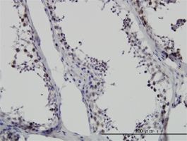 SMNDC1 antibody (ab56693) used in immunohistochemistry at 6ug/ml on formalin fixed and paraffin embedded human testis.