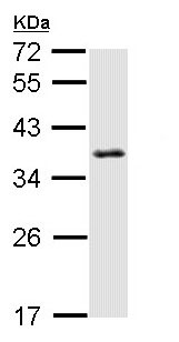 Anti-SMNDC1 antibody (ab155021) at 1/1000 dilution + HeLa whole cell lysate at 30 µg