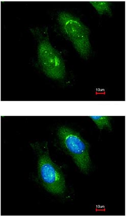 Immunofluorescent analysis of methanol-fixed HeLa cells labeling Survival motor neuron protein with ab155021 at 1/200 dilution. Lower panel is co-stained with Hoechst 33342.