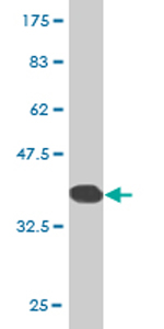 Anti-ZNF133 antibody (ab77461) at 1/500 dilution + immunogen at 0.2 µgSecondaryGoat anti-mouse IgG (H&L)-HRP conjugate at 1/5000 dilution