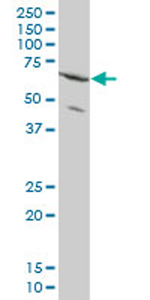 Anti-ZNF133 antibody (ab77461) at 1/500 dilution + HeLa cell lysate at 25 µgSecondaryGoat anti-mouse IgG (H&L)-HRP conjugate at 1/2500 dilution