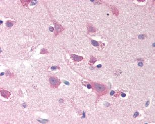 ab78069 used at 20 µg/ml, staining SMOC2 in human brain cortex.