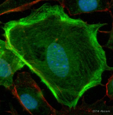 ab125884 staining smooth muscle Myosin heavy chain 11 in mouse primary embryonic epicardial cells by ICC/IF (Immunocytochemistry/immunofluorescence). Cells were fixed with formaldehyde, permeabilized with 0.5% Triton X-100 and blocked with 10% serum for 1 hour at 20°C. Samples were incubated with primary antibody (1/500 in PBS + 1% BSA + 10% goat serum + 0.1% Triton X-100) for 16 hours at 4°C. An undiluted Alexa Fluor® 488-conjugated goat anti-rabbit IgG polyclonal was used as the secondary antibody.See Abreview