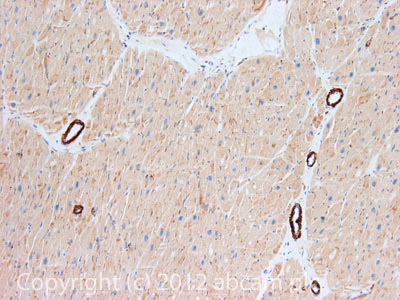 IHC image of smooth muscle Myosin heavy chain 11 staining in Human normal heart muscle formalin fixed paraffin embedded tissue section, performed on a Leica BondTM system using the standard protocol F. The section was pre-treated using heat mediated antigen retrieval with sodium citrate buffer (pH6, epitope retrieval solution 1) for 20 mins. The section was then incubated with ab125884, 1µg/ml, for 15 mins at room temperature and detected using an HRP conjugated compact polymer system. DAB was used as the chromogen. The section was then counterstained with haematoxylin and mounted with DPX.For other IHC staining systems (automated and non-automated) customers should optimize variable parameters such as antigen retrieval conditions, primary antibody concentration and antibody incubation times.