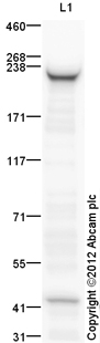 Anti-smooth muscle Myosin heavy chain 11 antibody (ab125884) at 1 µg/ml + Bladder (Mouse) Tissue Lysate at 10 µgSecondaryGoat Anti-Rabbit IgG H&L (HRP) (ab97051) at 1/10000 dilutiondeveloped using the ECL techniquePerformed under reducing conditions.