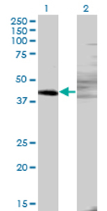 All lanes : Anti-ZNF193 antibody (ab77331) at 5 µg/mlLane 1 : ZNF193-transfected 293T cell lysateLane 2 : Non-transfected 293T cell lysateLysates/proteins at 25 µg per lane.SecondaryLane 1 : Goat anti-mouse IgG (H&L) HRP-conjugated at 1/2500 dilutionLane 2 : Goat anti-mouse IgG (H&L) HRP-cdonjugate at 1/2500 dilution