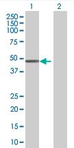 All lanes : Anti-ZNF193 antibody (ab67944) at 1/500 dilutionLane 1 : Transfected 293T cell lysate.Lane 2 : Non transfected 293T cell lysate.Lysates/proteins at 25 µg per lane.SecondaryGoat Anti-Mouse IgG (H&L)-HRP Conjugate at 1/2500 dilution