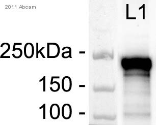 Anti-smooth muscle Myosin heavy chain 11 antibody (ab82541) at 1/2000 dilution + whole cell lysate prepared from human PASMC, P6 at 300 µgSecondaryHRP conjugated goat anti-rabbit polyclonal at 1/2000 dilutiondeveloped using the ECL technique