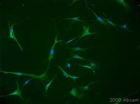 ab683 at a 1/250 dilution staining human Primary Aortic Smooth Muscle Cells by Immunocytochemistry. The cells were fixed for 20 minutes with cold acetone, blocked and incubated with the antibody overnight at 4C. Bound antibody was detected using an Alexa Fluor ® 488 conjugated Goat anti-Mouse antibody. This image is courtesy of an Abreview submitted by Amy Pyle on  on 7 March 2006.See Abreview