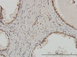 ZNF202 antibody (ab58179) used in immunohistochemistry at 3ug/ml on formalin fixed and paraffin embedded human prostate.