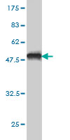 Western blot against tagged recombinant protein immunogen using ab58179 ZNF202 antibody at 1ug/ml.