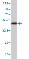 Western blot against tagged recombinant protein immunogen using ab58198 ZNF214 antibody at 1ug/ml.