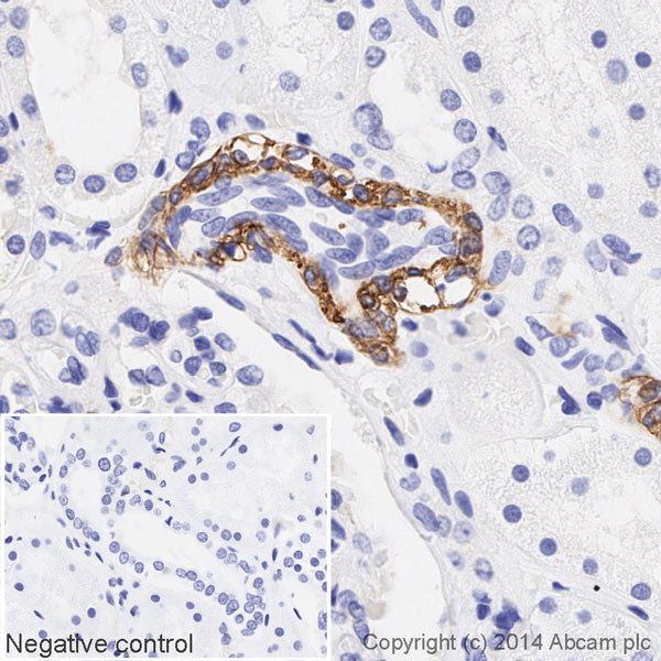 IHC image of smooth muscle Myosin heavy chain 11 staining in a section of formalin-fixed paraffin-embedded normal human kidney tissue*, performed on a Leica BOND. The section was pre-treated using heat mediated antigen retrieval with sodium citrate buffer (pH6, epitope retrieval solution 1) for 20mins. The section was then incubated with ab196983 at 1/500 dilution, for 15 mins at room temperature. DAB was used as the chromogen. The section was then counterstained with haematoxylin and mounted with DPX. The inset negative control image is taken from an identical assay without primary antibody.For other IHC staining systems (automated and non-automated) customers should optimize variable parameters such as antigen retrieval conditions, primary antibody concentration and antibody incubation times.*Tissue obtained from the Human Research Tissue Bank, supported by the NIHR Cambridge Biomedical Research Centre