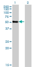 All lanes : Anti-ZNF232 antibody (ab77731) at 5 µg/mlLane 1 : ZNF232 transfected 293T cell lysateLane 2 : Non transfected 293T cell lysateLysates/proteins at 25 µg per lane.SecondaryGoat Anti-Mouse IgG (H&L)-HRP Conjugate at 1/2500 dilution
