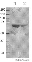 All lanes : Anti-smooth muscle Myosin heavy chain I antibody [3F8] (ab682) at 1/250 dilutionLane 1 : 30ug/lane human 293 cells (whole cell lysate) transiently transfected with a CBFB-SMMHC plasmidLane 2 : 30ug/lane human 293 cells (whole cell lysate) transiently transfected with a CBFB-SMMHC plasmidSecondaryAlkaline Phosphatase conjugated goat anti-mouse antibodydeveloped using the ECL techniquePerformed under reducing conditions.Observed band size : 68 kDa (why is the actual band size different from the predicted?)Exposure time :  5 minutesThis image is courtesy of an anonymous AbreviewSee Abreview