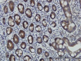 ZNF259 antibody (ab56419) used in immunohistochemistry at 3ug/ml on formalin fixed and paraffin embedded human small Intestine.