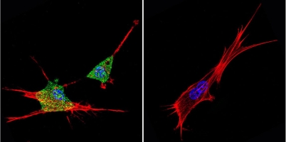 Immunofluorescence analysis of formaldehyde-fixed mouse NIH 3T3 cells, probed without (control, right panel) or with ab171117 (left panel) labeling ZNF259 (green) at a 1/20 dilution overnight. Slides were washed with PBS and incubated with a DyLight-488 conjugated secondary antibody. F-Actin was stained with Phalloidin (red) and nuclei with DAPI (blue).